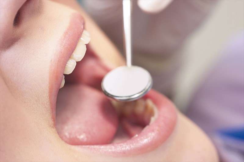 信頼性の高いインプラントを行える歯医者・港区で納得の治療