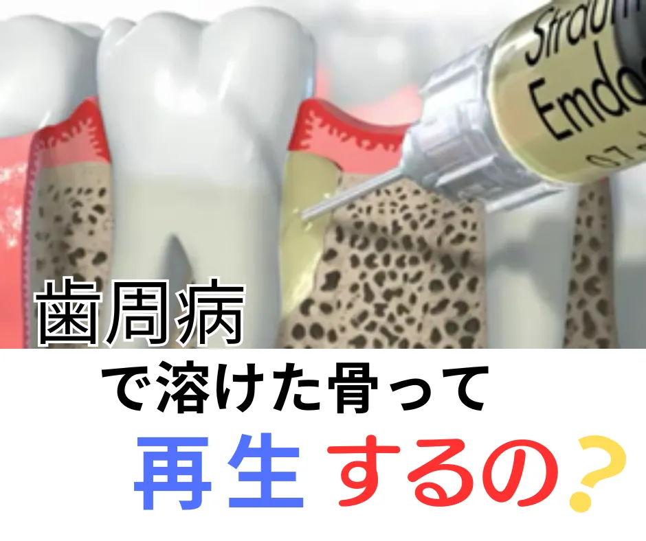 歯周病で溶けた骨は再生できるの？